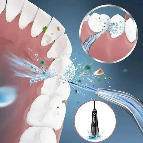 Irrigador Oral Portátil - WaterJet - Inova Mix Store Irrigador Oral Portátil - WaterJet